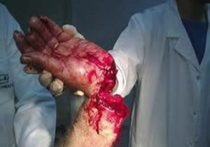 hand_cut_941719926