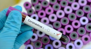 CORONA_00_04092020